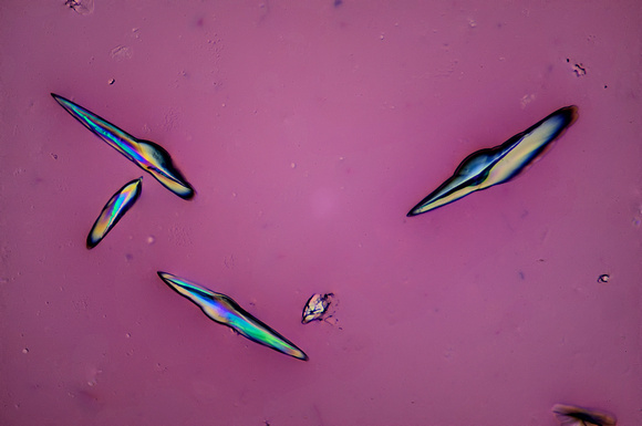 Tartrate Crystals from Red Wine, 100x