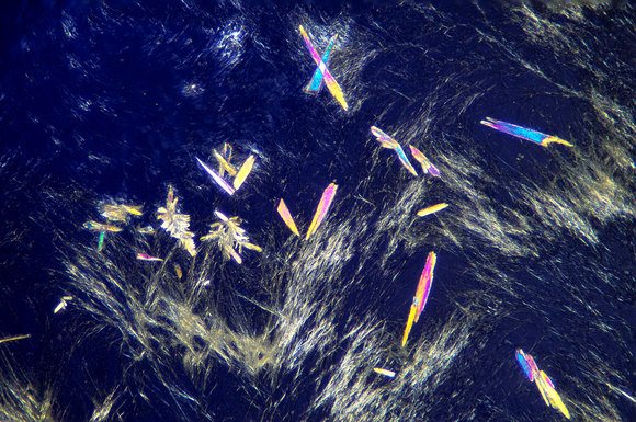 Aleve (Naproxen) crystals, 400x