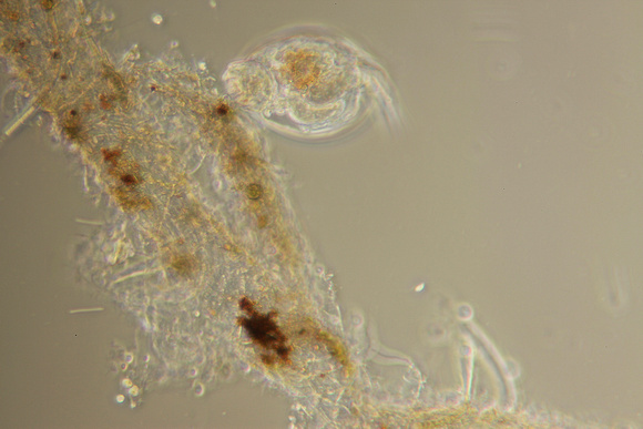 Lepadella ovalis rotifer. 400x magnification, phase contrast.