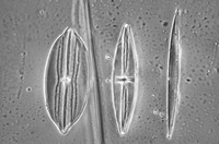 Diatoms at approx. 600x maginification