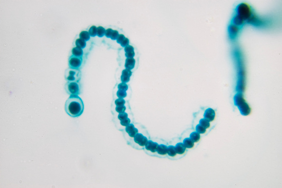 Nostoc Cyanobacterium, 1000x oil immersion