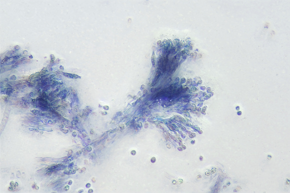 Penicillium Fungus with Spores, 400x, phase contrast