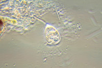 Vorticella. 400x magnification, phase contrast.